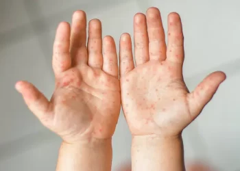 Trạm Y tế Liên Nghĩa – Bản tin Tay chân miệng