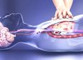 CẤP CỨU NGƯNG HÔ HẤP TUẦN HOÀN