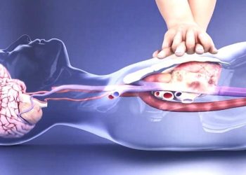 CẤP CỨU NGƯNG HÔ HẤP TUẦN HOÀN