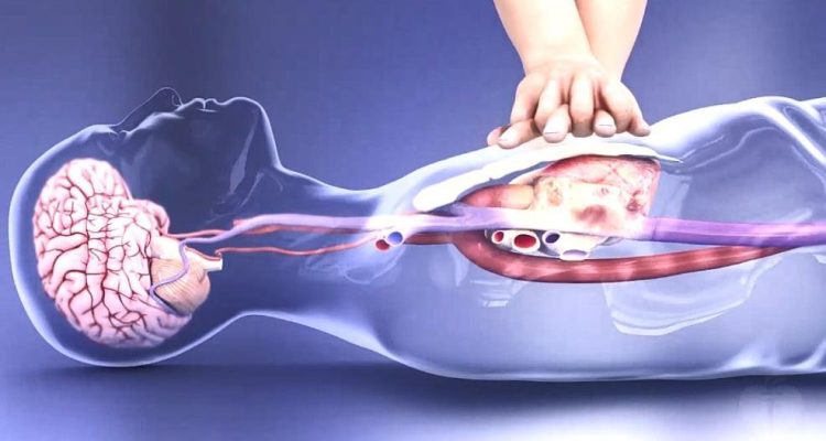 CẤP CỨU NGƯNG HÔ HẤP TUẦN HOÀN
