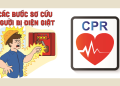 CẤP CỨU ĐIỆN GIẬT