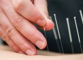 CHỮA BỆNH BẰNG PHƯƠNG PHÁP CHÂM CỨU