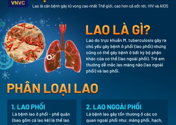 BỆNH LAO VÀ CHƯƠNG TRÌNH KHÁM TẦM SOÁT BỆNH HÔ HẤP MIỄN PHÍ BẰNG CHỤP X –QUANG PHỔI TẠI XÃ NINH GIA