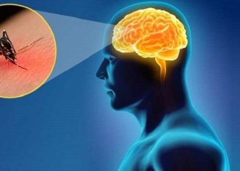 VIÊM NÃO NHẬT BẢN