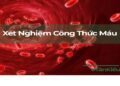 XÉT NGHIỆM CÔNG THỨC MÁU  TẠI TRUNG TÂM Y TẾ KHU VỰC ĐỨC TRỌNG